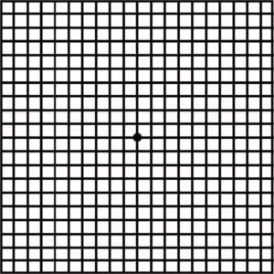 Tracción vítreomacular con prueba de Amsler en West Texas Eye Associates