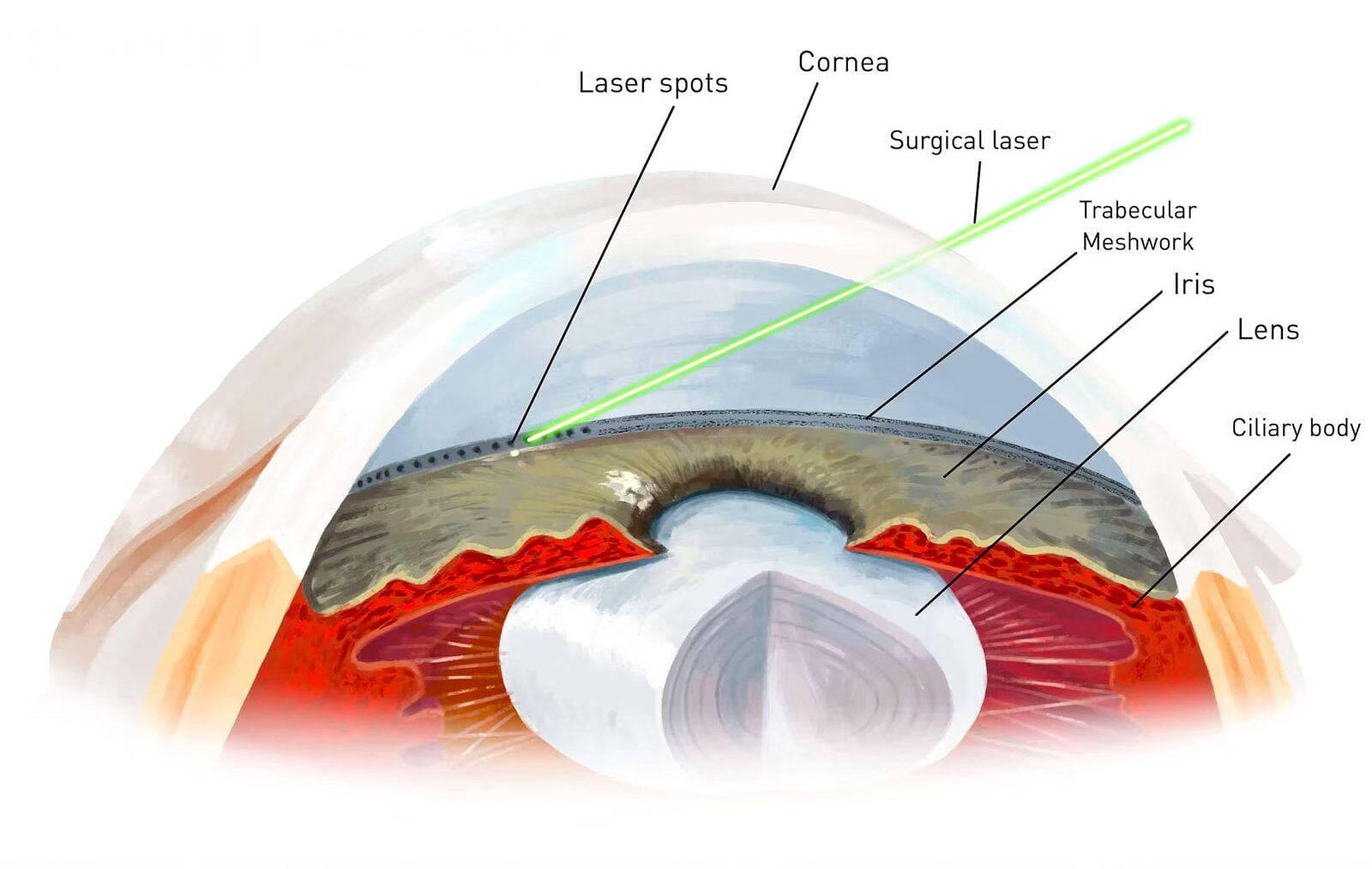 Selective Laser Trabeculoplasty (SLT) at West Texas Eye Associates, patient at slit lamp for glaucoma laser treatment