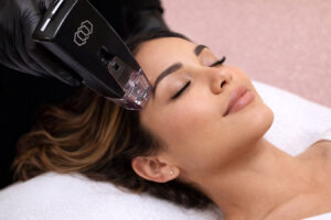 Morpheus8 is a great option to help treat you acne skin issues at Aesthetic Center of Lubbock in West Texas.