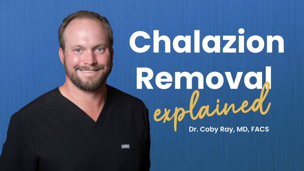 Chalazion removal explained by Dr. Coby Ray, MD, FACS, smiling in black scrubs against a blue background.