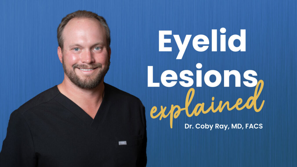 Eyelid Lesion Thumbnail for video by Dr. Coby Ray.