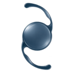 Blue intraocular lens (IOL) implant used in advanced cataract surgery to replace the eye’s natural lens.